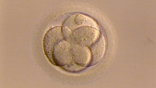 Menschliche Eizellen erstmals im Labor zur Reife gebracht