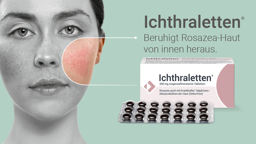 Anzeige für Ichthraletten bei Rosazea: Frauengesicht mit hervorgehobener geröteter Wange; daneben Packung und Blister mit Tabletten.