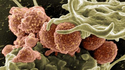 Zulassungsempfehlung für Delafloxacin