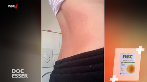 swr-test waermepflaster8 scs