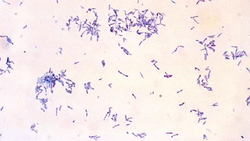 Corynebacterium diphteriae CDC