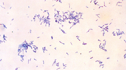 Corynebacterium diphteriae CDC