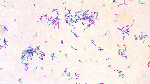 Corynebacterium diphteriae CDC