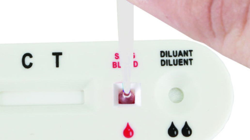 HIVSelbsttests Apotheke schlägt Drogerie APOTHEKE ADHOC