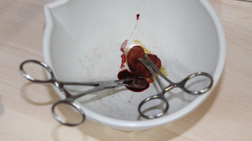 apo aurnhammer dreharbeiten4 apo aurnhammer