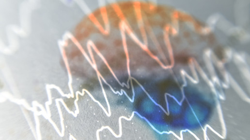 Cenobamat: Weniger Anfälle, gute Verträglichkeit