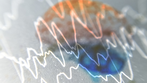 Cenobamate: Aufnahme ins Härtefallprogramm