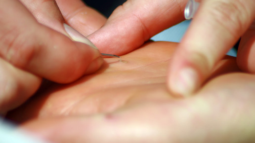 hand splitter pinzette pixeliode mark1480