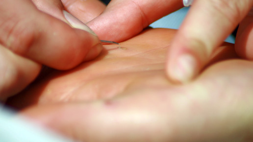 hand splitter pinzette pixeliode mark1480