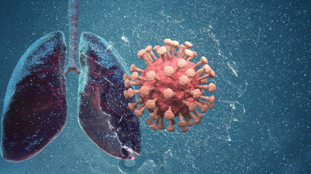 Omikron: Kaum Virusvermehrung in den Lungen