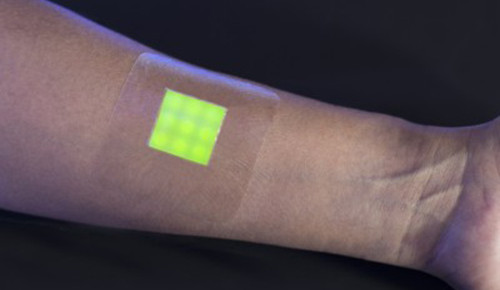 leuchtender verband infizierte wunde university-of-bath