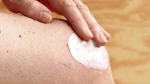 NSAR bei Arthrose: Topisch vor oral