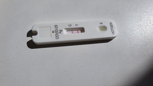 Amtsärzte: Nur jeder 2. Corona-Fall bekannt