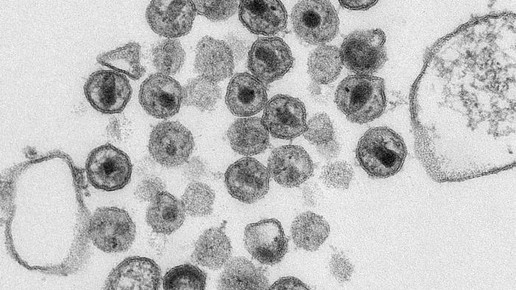 hiv 13472 CDC Maureen Metcalfe  Tom Hodge