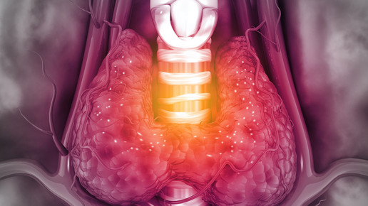 Schilddrüse: „Nahrungsergänzungsmittel unnötig teuer“