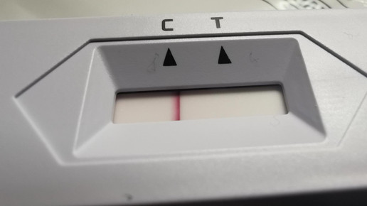 Laientests: Das meinen die Kolleg:innen