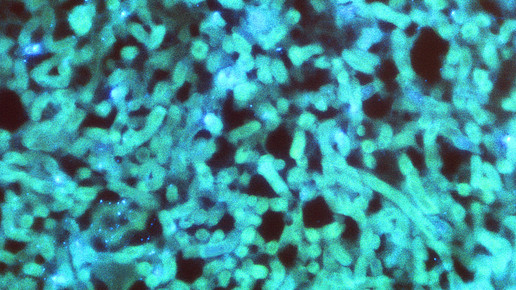 aspergillus nidulans cdc Dr William Kaplan