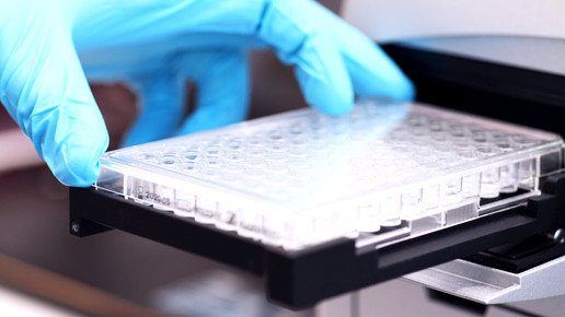 bakterienpopulation pseudomonas aeruginosa Christian Urban Uni Kiel