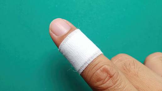 Zeigefinger abgestorben: Sepsis-Risiko im Garten