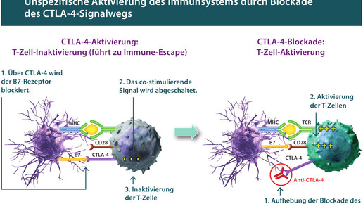 immunsystemaktivierung ipilimumab bristol myers squibb