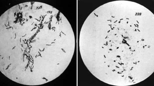 160624 rki mikrobiologie rki