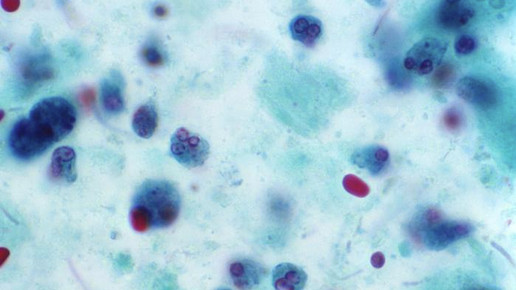 necrotic cell CDC Dr. Mae Melvin