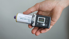 Pumpe gegen Parkinson