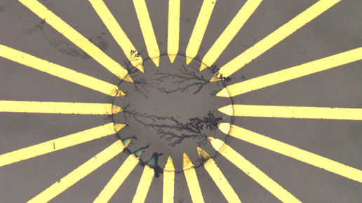 KI-Implantat erkennt Herzrhythmusstörungen