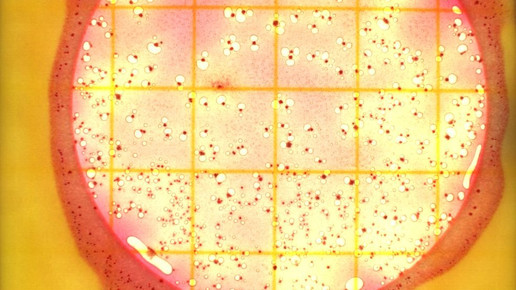 bakterien Sebastian Karkus pixelio.de