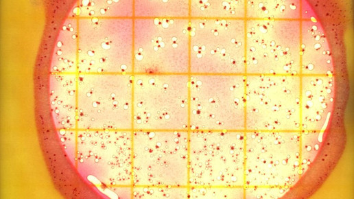 bakterien Sebastian Karkus pixelio.de