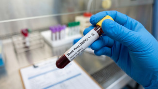 Blutprobe mit detektiertem Ebolavirus