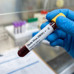 Ebola: Patient aus Krankenhaus entlassen Ebola: Patient aus Krankenhaus entlassen