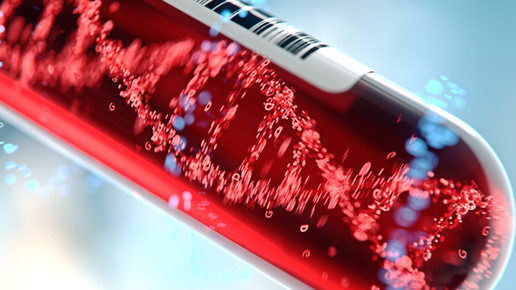 Transferrin: Eisentransporter als Frühindikator?