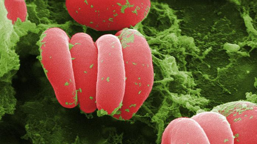 Infarktrisiko: Protein als Doppelagent