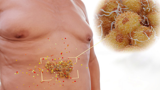 Abnehmen mit braunem Fett