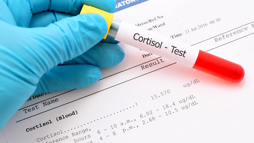 Corona: Welchen Einfluss haben Hormone?