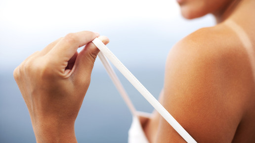 Soventol Foto Sonnenbrand