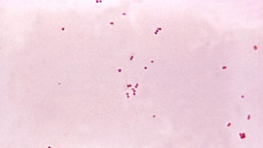 neisseria meningitidis cdc dr brodsky