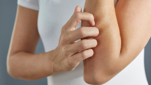 Foto: Eine Person kratzt sich am Ellbogen.