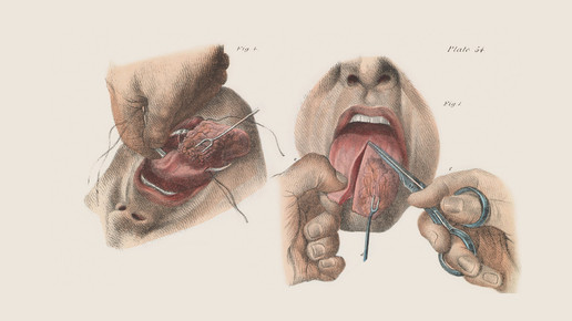 victorian zunge 01 wellcomecollection