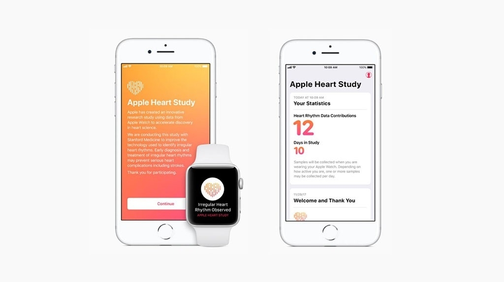 Apple Watch entdeckt 2000 Herzerkrankungen