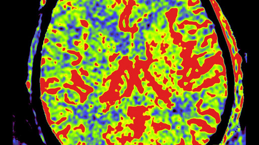 Siemens verkauft Klinik-IT-Sparte