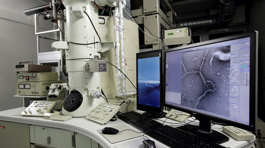 kryo elektronenmikroskop Maike Gloeckner uni halle