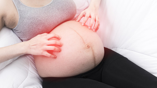 Schwangerschaftsexanthem – besondere Hautveränderung