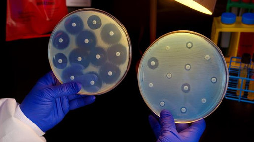 Ideenpapier gegen Antibiotika-Resistenzen