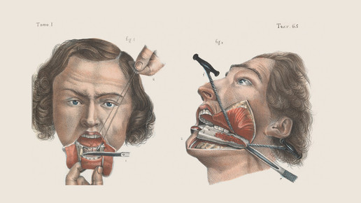 victorian kiefer 01 wellcomecollection