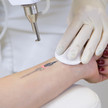 Lasermedizin: Von kosmetisch bis medizinisch Lasermedizin: Von kosmetisch bis medizinisch