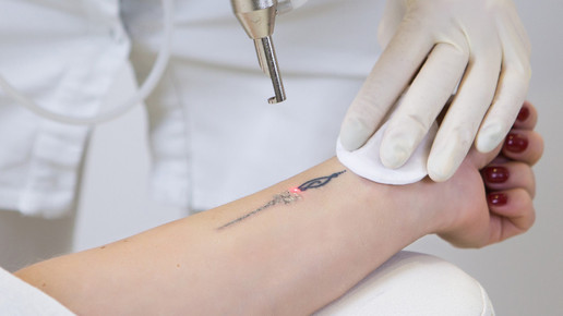 Lasermedizin: Von kosmetisch bis medizinisch