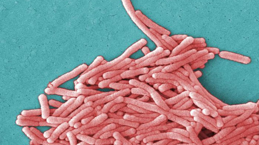 Legionella pneumophila CDC Janice Haney Carr