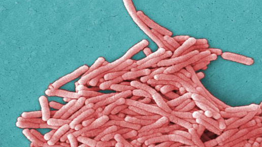 Legionella pneumophila CDC Janice Haney Carr